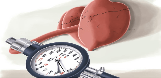 HYPERTENSION:Sensibiliser le public aux dangers de cette maladie