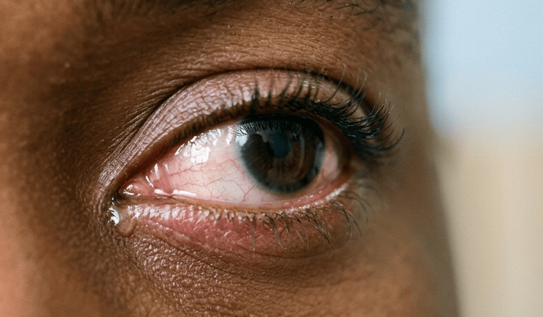 Close-up of a brown eye with visible eyelashes and blood vessels